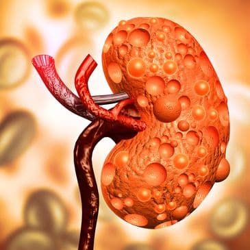 Kidney & Upper Tract Cancers
