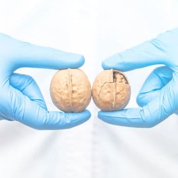 Testicular Cancer