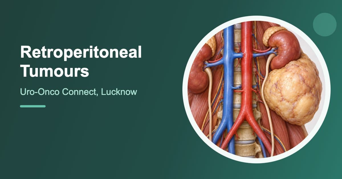 Retroperitoneal Tumours illustration